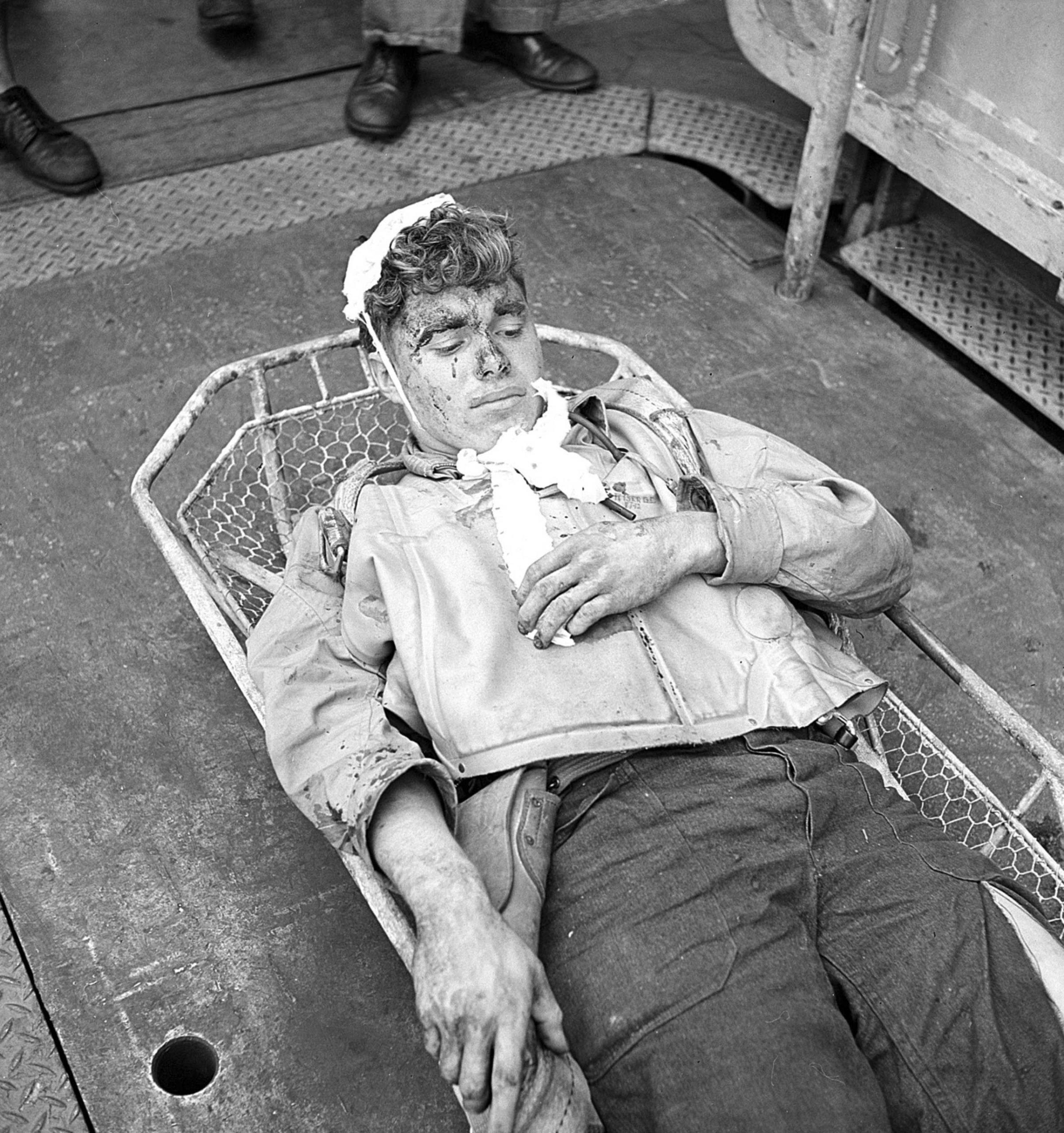 An injured air gunner from a Douglas SBD Dauntless dive bomber